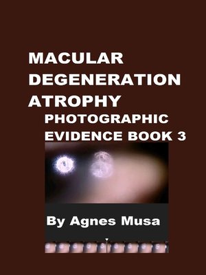 cover image of Macular Degeneration Atrophy, Photographic Evidence Book 3